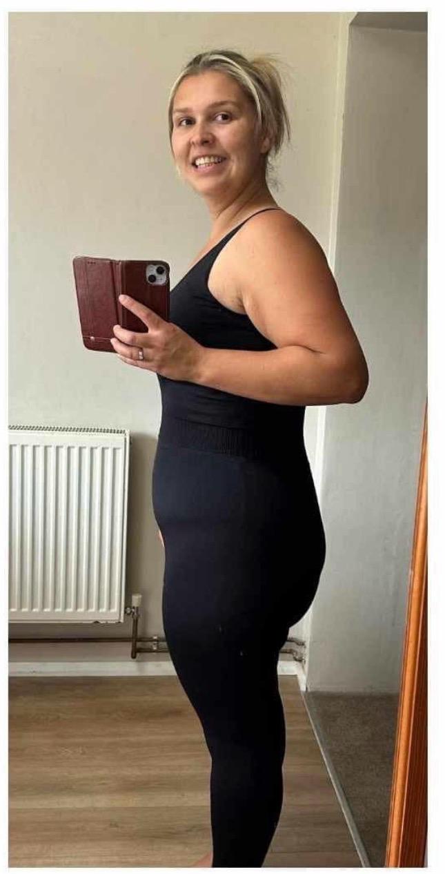 Emma after GLP-1 treatment