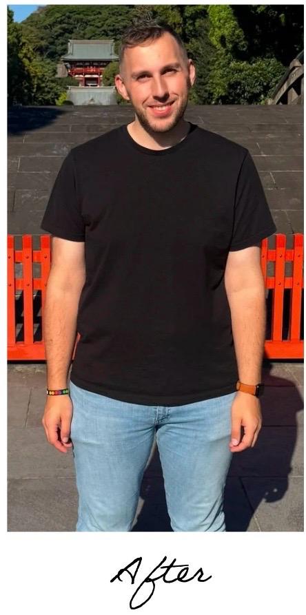 James after GLP-1 treatment